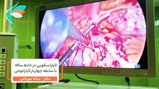 لاپاراسکوپی در خانم 45 ساله