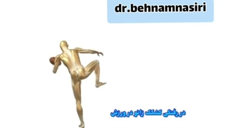 در رفتگی کشک زانو