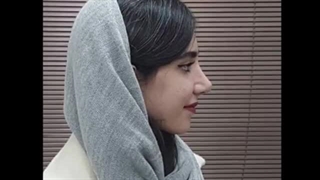 حدود یک ماه پس از جراحی زیبایی بینی به سبک نچرال استتیک