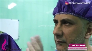 بلافاصله پس از جراحی بینی گوشتی