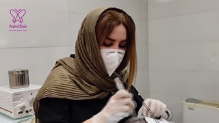 مزونیدلینگ