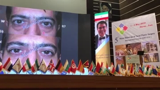 سخنرانی پروفسور کشکولی | کنگره جراحی های پلاستیک صورت شیراز | جراح پلک تهران