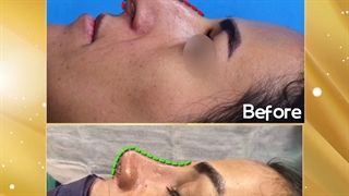 جراحی بینی | فوق تخصص جراحی پلاستیک | دکتر عبدالرضا روئین تن
