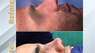 جراحی زیبایی بینی | فوق تخصص جراحی پلاستیک | دکتر عبدالرضا روئین تن