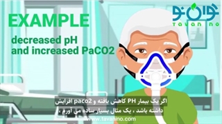 بای پپ و نحوه عملکرد دستگاه بای پپ