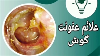علائم عفونت گوش