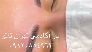 آموزش میکروبلیدینگ | 09120854963