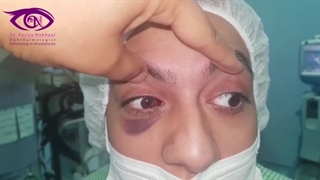 ویدئو واقعی شکستگی کف اربیت