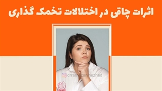 اثرات چاقی در اختلالات تخمک گذاری