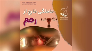 حاملگی خارج از رحم