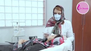 جلسه اول بعداز جراحی بینی