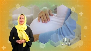 صحبت های دکتر نسرین زارع پور در مورد IUI و نازایی