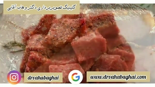 چه مواد غذایی برای ضعیف شدن پروستات نباید خورد؟