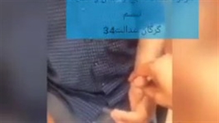 درمان اختلال بلع در پارکینسونیسم