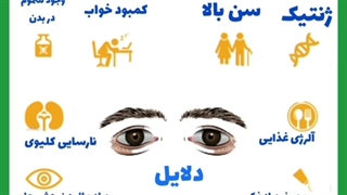 دلایل پف زیر چشم