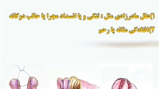 مسیر ادرار چندجهتی