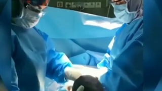 نمونه ای از سزارین پسر توسط دکتر مریم حاتمی