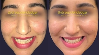 این بیمار قبلاً در مرکز دیگری تحت درمان قرار گرفته | دکتر سپیده دادگر