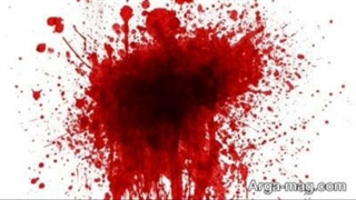 اظهار نظر زود هنگام        دکترعلی فلاحیان