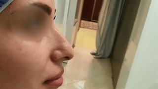 فیلم کامل عمل بینی