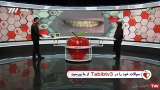 علت رنگ زرد دندان چیست؟؟؟!!!