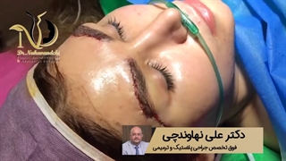 فیلم جراحی لیفت ابرو از نزدیک