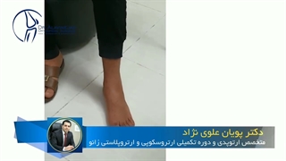 پیگیری بعد از جراحی شکستگی پاشنه