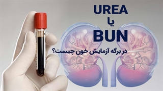 نماد urea در آزمایش خون چیست؟
