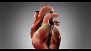 سکته قلبی چگونه اتفاق می افتد؟