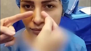 عمل بینی استخوانی غضروفی