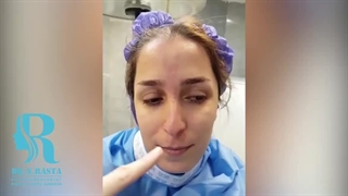 عمل بینی استخوانی