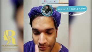 جراحی بینی کاملا پهن