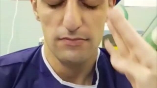 رینوپلاستی زیباجوی عزیزمون