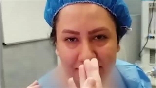 جراحی زیبایی بینی کاملا گوشتی