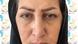 دکتر مهدیه بلفارو پلک