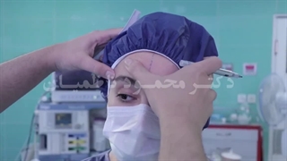اندوسکوپیک ابرو زیباجوی عزیزمون