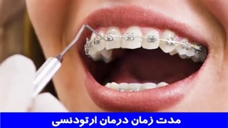 مدت زمان درمان ارتودنسی | دکتر احسان مهریزی