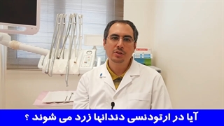 آیا در ارتودنسی دندان ها زرد میشوند ؟ | دکتر احسان مهریزی