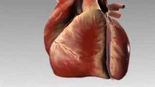 چطور حمله قلبی اتفاق می افتد؟