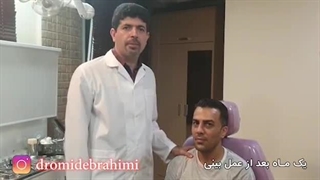 عمل بینی