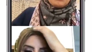 فیلم جالب در مورد انواع جراحی های پلک