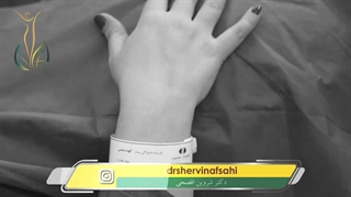 زایمان سزارین