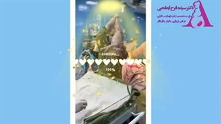 زایمان سزارین - طاها جان - دکتر فرح ابطحی درمان ریزش مو