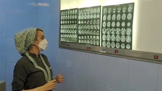 تومور بسیار بزرگ مننژیوم