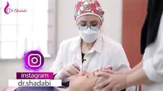 جراحی بلفاروپلاستی بلافاصله بعداز عمل