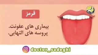 فیلم تشخیص بیماری ها از رنگ زبان