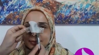 جراحی بینی نیمه فانتزی