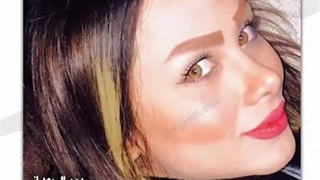 نمونه کار جراحی بینی
