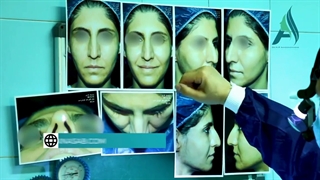 فیلم کامل جراحی بینی