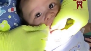 بهداشت دهان کودکان| دکتر ماریتا شکاریان